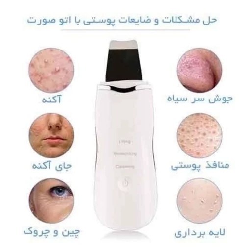 اتو صورت